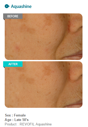 aquashine1-jpg.png aquashine1-jpg.png